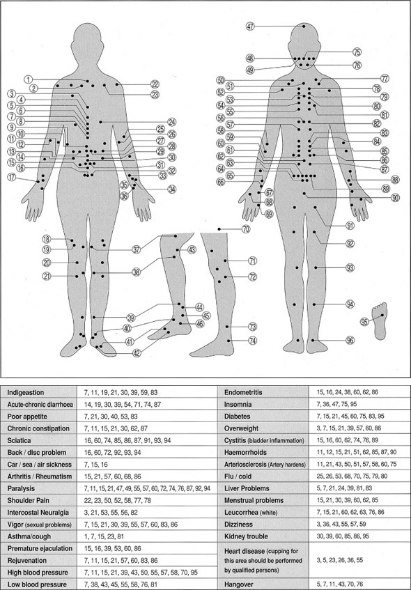 Cupping Therapy Placement Chart