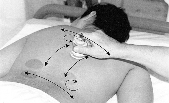 Cupping_set_Therapy_06